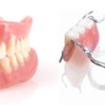 Phục Hình Răng Bằng Hàm Giả Tháo Lắp 4
