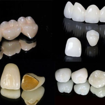 Răng Sứ CHROME COBALT
